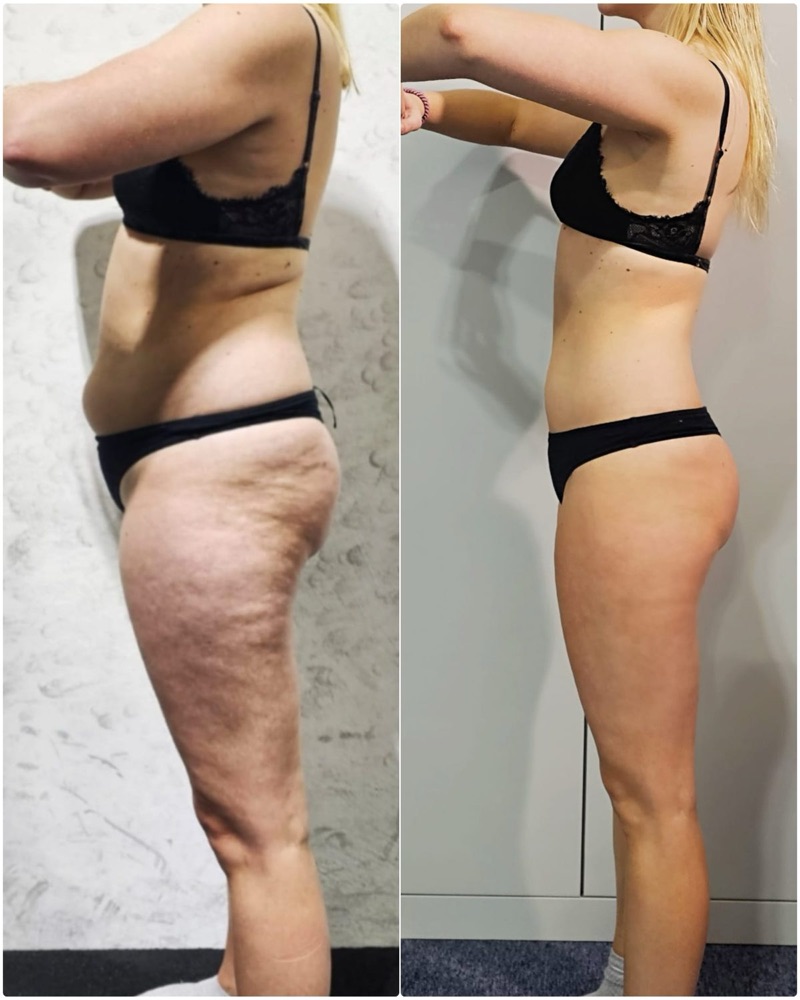 Before and after of a Fit By Charro client, side view