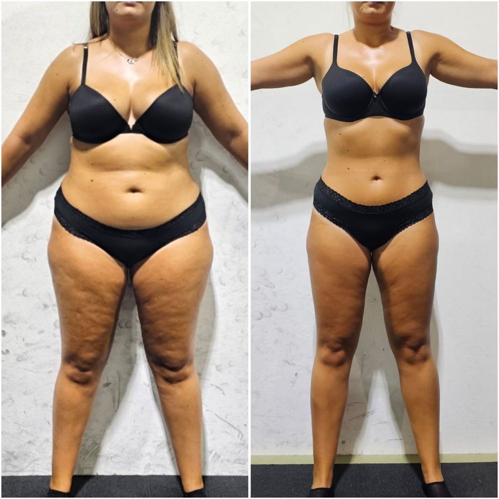 Before and after of a Fit By Charro client