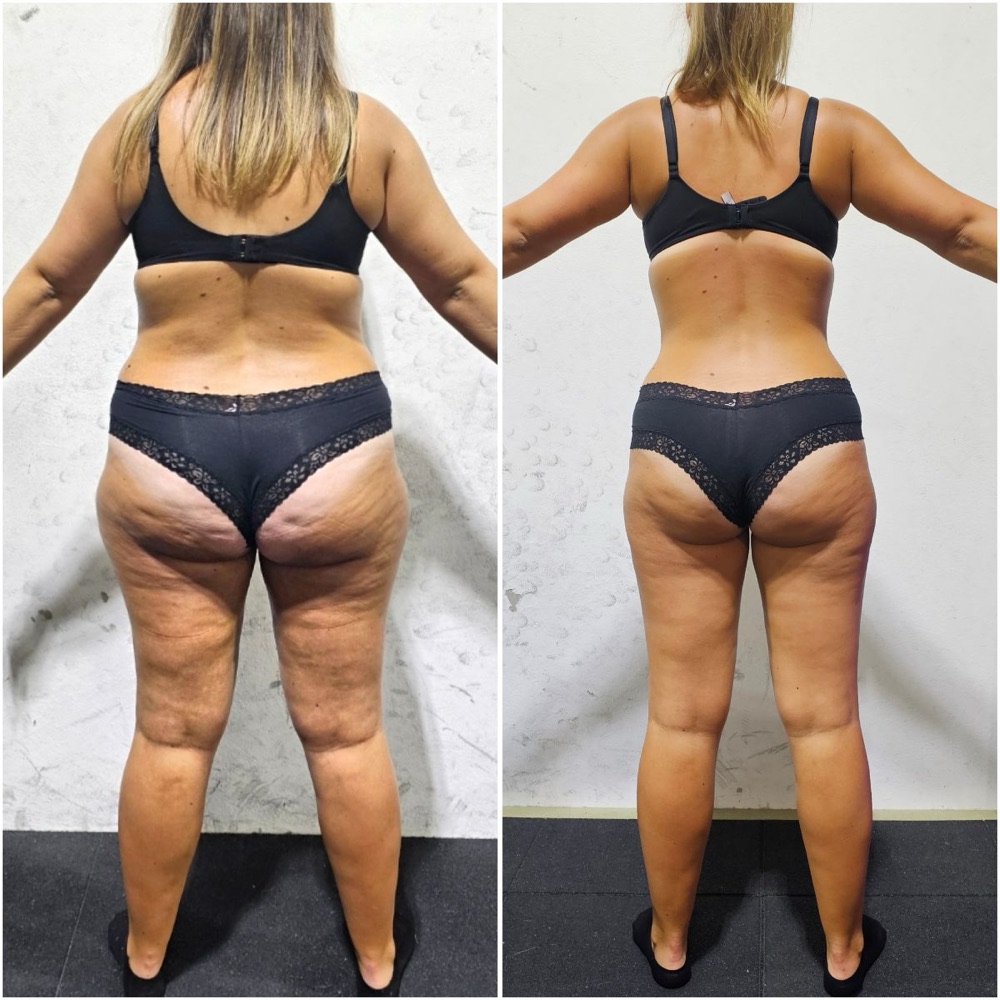 Before and after of a Fit By Charro client, back view