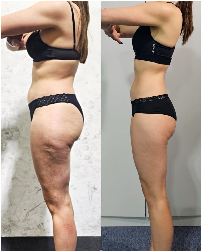 Before and after of a Fit By Charro client, side view