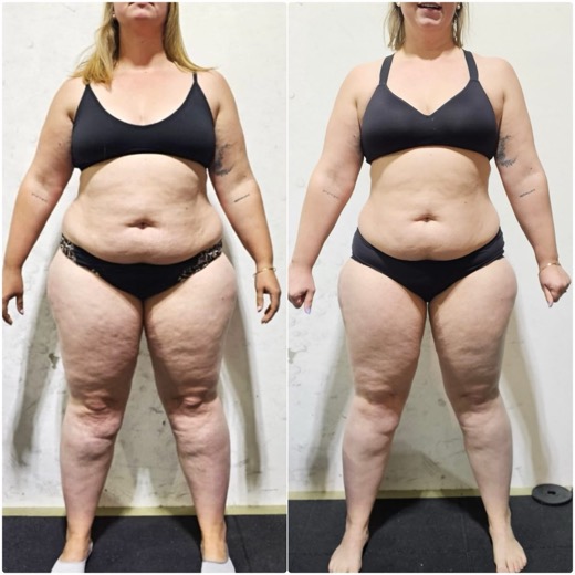 Before and after, client 1