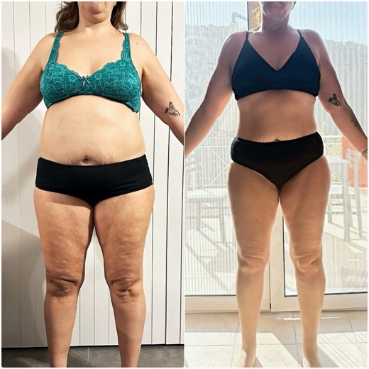 Before and after, client 2