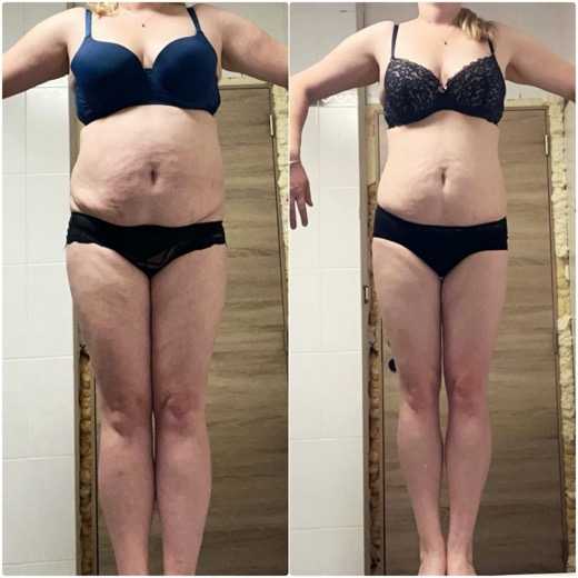 Before and after, client 7