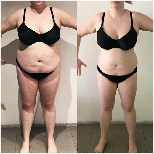 Before and after, client 3