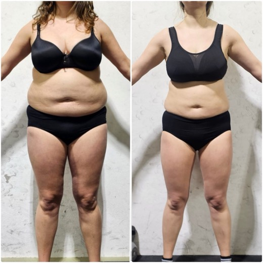 Before and after, client 4