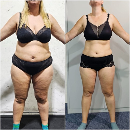 Before and after, client 5